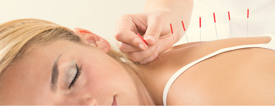 Other therapies acupunture